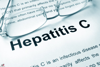 همه چیز در مورد هپاتیت سی (Hepatitis C)