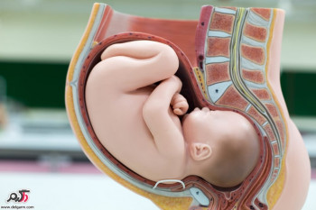 علت عمل سرکلاژ در بارداری چیست؟