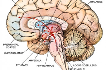 بیمار مبتلا به سکته مغزی میتواند روزه بگیرد؟