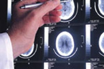 تومور مغزی چیست؟ و تشخیص تومور مغزی به چه صورت است؟