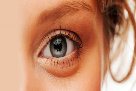 تزریق چربی زیر چشم برای رفع گودی و کبودی