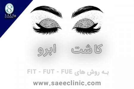 معجزه ی عصر جدید در کاشت مو و کاشت ابرو