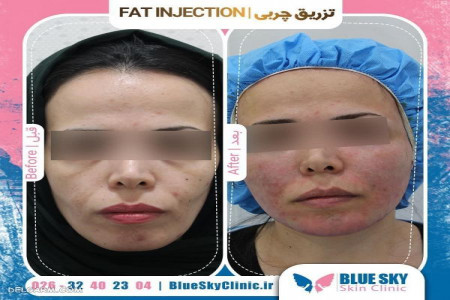 معرفی کلینیک پوست و کاشت مو آسمان آبی
