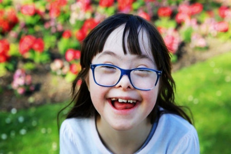 سندرم داون چیست؟ علل، علائم و درمان سندرم داون