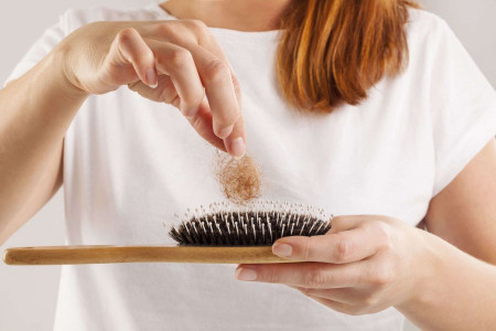 آلوپسی چیست و بهترین درمان آن کدام است ؟