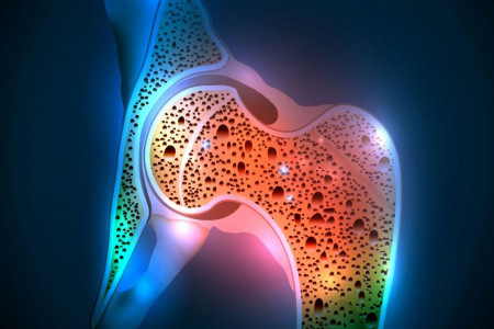 شرط لازم استفاده از چای سیاه برای داشتن استخوان سالم