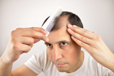 لیست داروهایی که باعث ریزش مو می شود