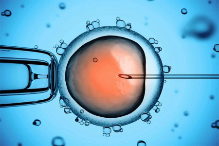 مزایای IVM نسبت به IVF برای درمان ناباروری