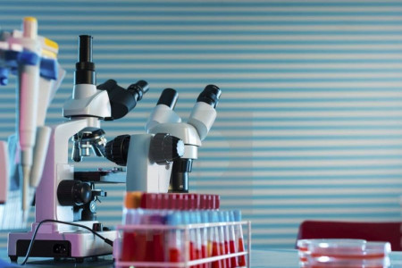 علت بالا و پایین بودن B2MG در آزمایش خون