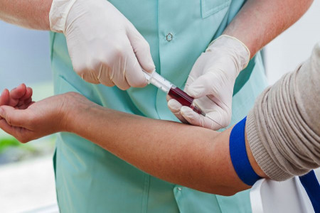 علت بالا و پایین بودن Anti-ds-DNA Ab در آزمایش خون