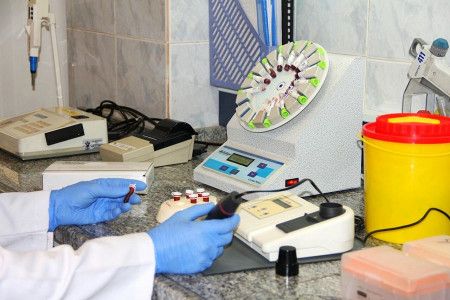 آزمایش بررسی سنگ کلیه