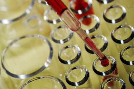 بررسی سطح هورمون گاسترین