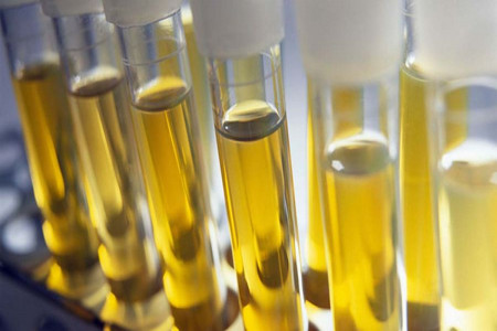 تشخیص بیماری موکوپلی ساکاریدوزیس