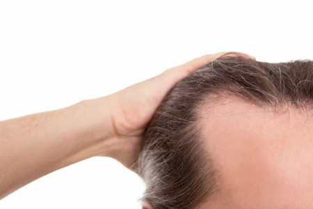 فواید باورنکردنی تونیک مو بلک بری