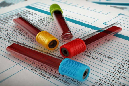MCH در آزمایش خون