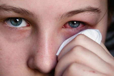 التهاب چشم : 11 راهکار خانگی برای درمان عفونت چشم