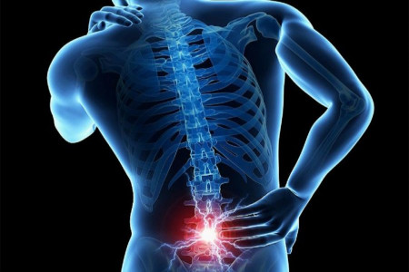 فرسایش دیسک کمر (دیسک سیاه) چیست و چه علائمی دارد ؟