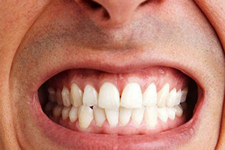 علائم و راههای درمان دندان قروچه در خواب چیست ؟