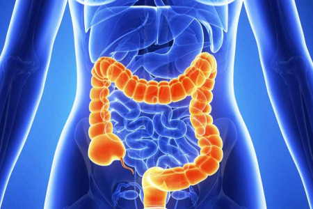 علائم ولولوس (پیچ خوردگی روده) چیست و چگونه درمان میشود ؟