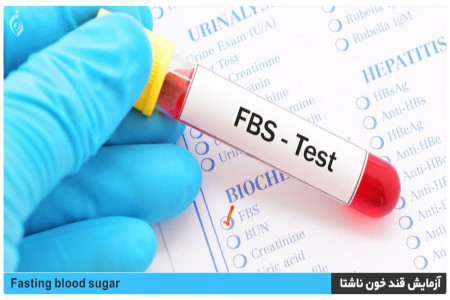 آزمایش قند خون ناشتا (FBS) باید چند باشد و چه شرایطی دارد ؟