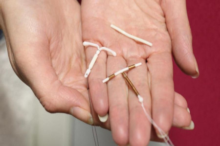 انواع آی یو دی (IUD) : مزایا و معایب آی یو دی های هورمونی