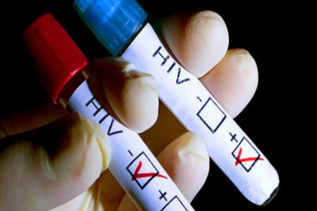 جواب آزمایش ایدز : تفسیر کامل نتایج آزمایش (HIV) ایدز