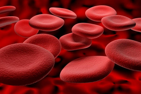 علائم اضافه بار آهن چیست و چگونه درمان میشود ؟