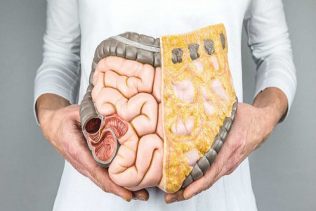زخم دوازدهه چیست (Duodenal ulcer) چیست و چگونه درمان میشود ؟