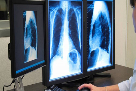 لیست آدرس و تلفن مراکز رادیولوژی و سونوگرافی در کرمانشاه و حومه