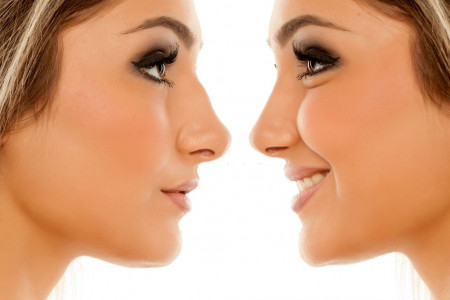 جراحی بینی را برای چه باید انجام بدیم و باید چه نکاتی رو لحاظ کنیم ؟