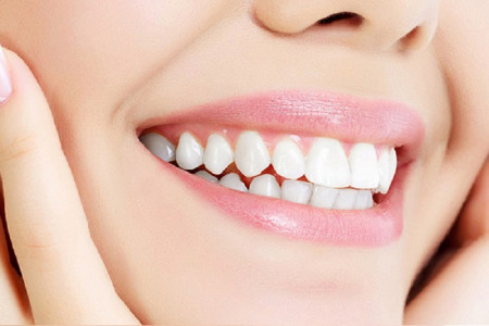 طراحی لبخند به چند روش و چگونه انجام میشود ؟