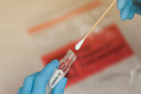 فرق تست PCR با تست آنتی بادی کرونا چیست ؟