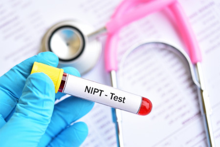 آزمایش قبل از تولد nipt چیست و چه کاربردی دارد ؟