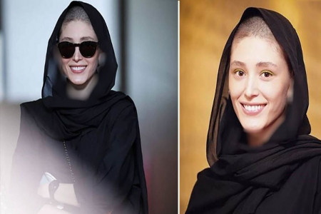 عکس کچل فرشته حسینی
