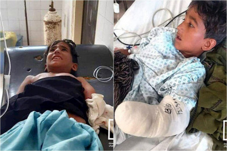 قطع دست کودک چابهاری بر اثر حمله ی تمساح