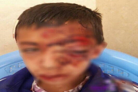 سقوط وحشتناک یک دانش آموز از کوه بخاطر اینترنت و شبکه شاد ؟!