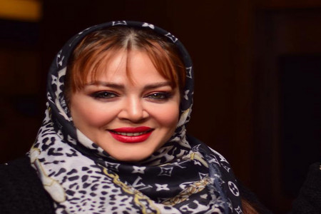 عمل زیبایی بهاره رهنما : فقط بوتاکس کردم
