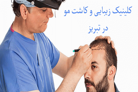 لیست کلینیک های زیبایی و کاشت مو در تبریز + آدرس و تلفن