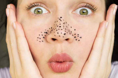 8 راهکار فوق العاده برای جلوگیری از ایجاد جوش های سر سیاه