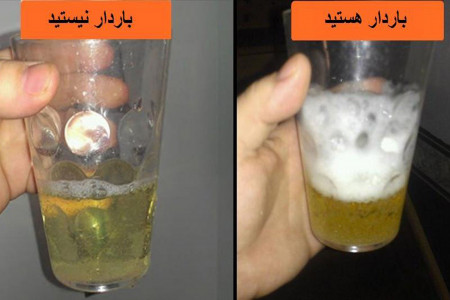 آموزش تست بارداری با شامپو و معایب آن