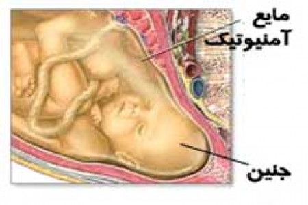به خشکی افتادن جنین یعنی چه؟