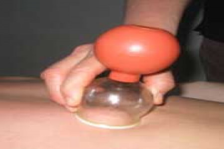 همه چیز درباره حجامت