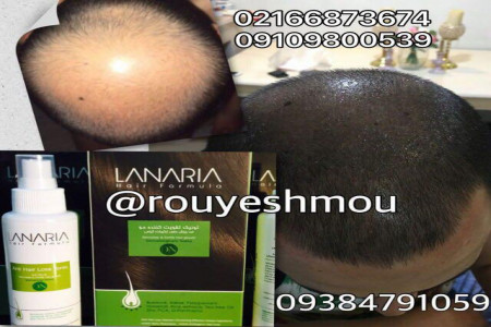 همه چیز درمورد دکتر نوروزیان وپکیج رویش مجدد مو