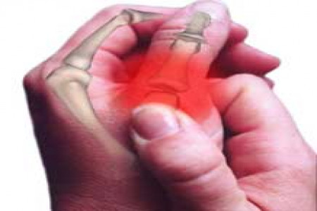 7 روش موثر برای درمان آرتروز شما