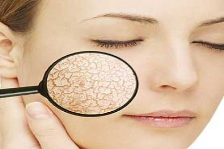 نکات مهم برای جلوگیری از خشکی پوست در پاییز