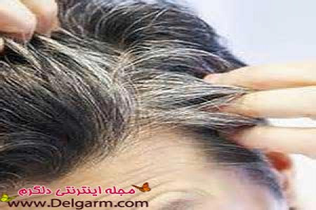 سفید شدن مو و مقابله با سفیدی موها