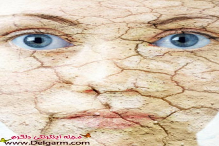 لوسیون برای پوست خشک - خانگی