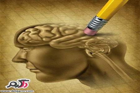 معرفی نشانه های اولیه مبتلا شدن به آلزایمر