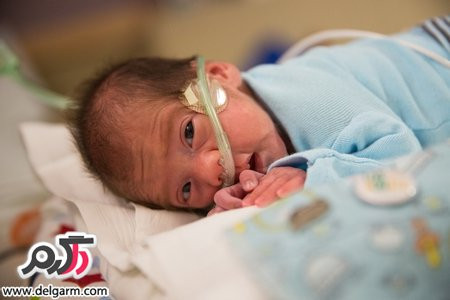 زنده نگه داشتن مادر مرگ مغزی شده به خاطر تولد نوزاد
