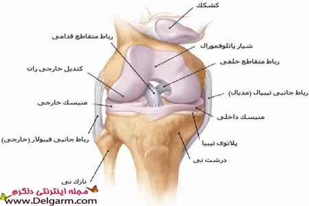 درمان پارگی رباط داخلی زانو + عکس